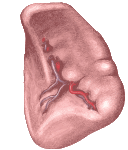 Enlarged spleen