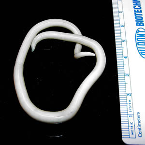 Ascaris lumbricoides.jpeg