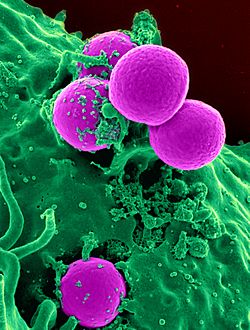 Human neutrophil ingesting MRSA