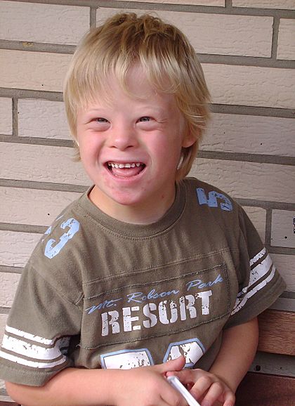 Boy with Down Syndrome