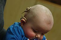 Infant with cochlear implant