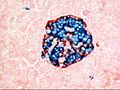 Human pancreatic islet