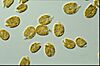 CSIRO ScienceImage 6736 dinoflagellate.jpg
