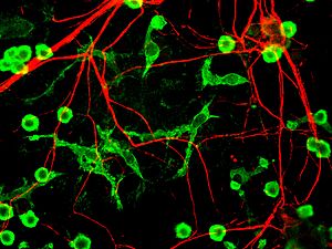 Microglia and neurons