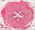 2607 Ureter