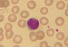 Lymphocyte2