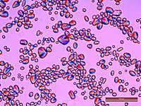 Potato Starch Polarized light 100x