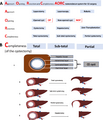 Vuitton et al - International consensus on terminology - parasite200043-fig3