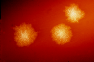 Clostridium difficile colonies.png