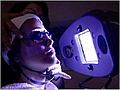 Blue Light acne phototherapy iClear