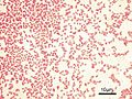 Pseudomonas aeruginosa Gram