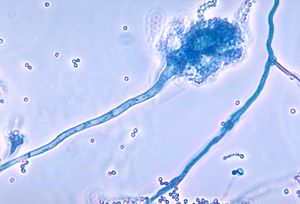 Aspergillus fumigatus 01