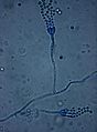 Penicillium Spp.