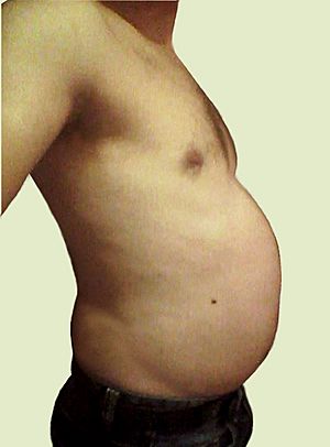 Abdominal obesity in men