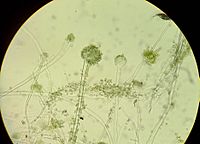 Aspergillus oryzae