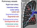 Computed tomograph of pulmonary vessels