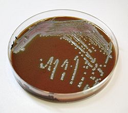 Chocolate agar 1