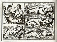 Aztec smallpox victims