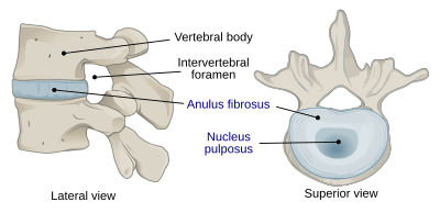 716 Intervertebral Disk