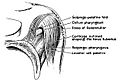 Torus tubarius dissection