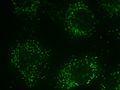 Peroxisome in rat neonatal cardiomyocyte