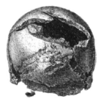 Worlebury broken skull