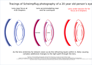 Human Lens Scheimpflug layers