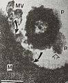 OMV-macrophage99