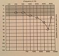 Example of Notched Audiogram