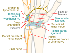 Guyon canal syndrome zones