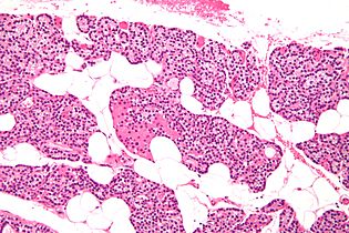 Parathyroid gland intermed mag