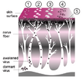 A Course of Shingles diagram