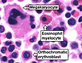 Trilineage hematopoiesis, annotated