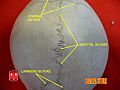 Sagittal suture 2