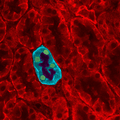 Kidney tubules