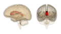 Corpus callosum