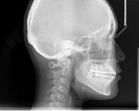 Cephalometric radiograph