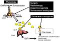 Acromegaly treatment diagram