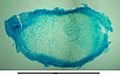 Cross-section through root nodule of (Vicia spec.)