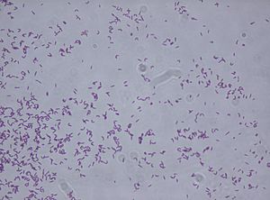 Rhodococcus fascians.jpg