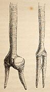 Tracheae and Bronchial tubes of male and female Shoveler ducks from Yarrell History of British Birds 1843