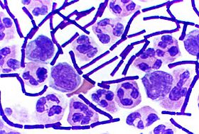 Gram Stain Anthrax