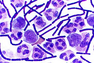 Gram Stain Anthrax