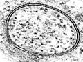 Annular Gap Junction Vesicle