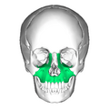 Maxilla anterior