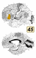 Brodmann Cytoarchitectonics 45