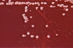 Pseudomonas aeruginosa 01.jpg