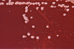 Pseudomonas aeruginosa 01