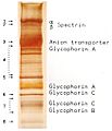 RBC Membrane Proteins SDS-PAGE gel