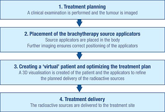 Brachytherapy procedure flow